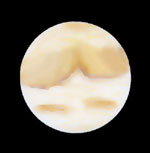 [Mars 05.09.03 Peter von Bagh]