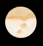 [Mars 07.09.03 Peter von Bagh]